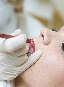 Behandlung der Lippen